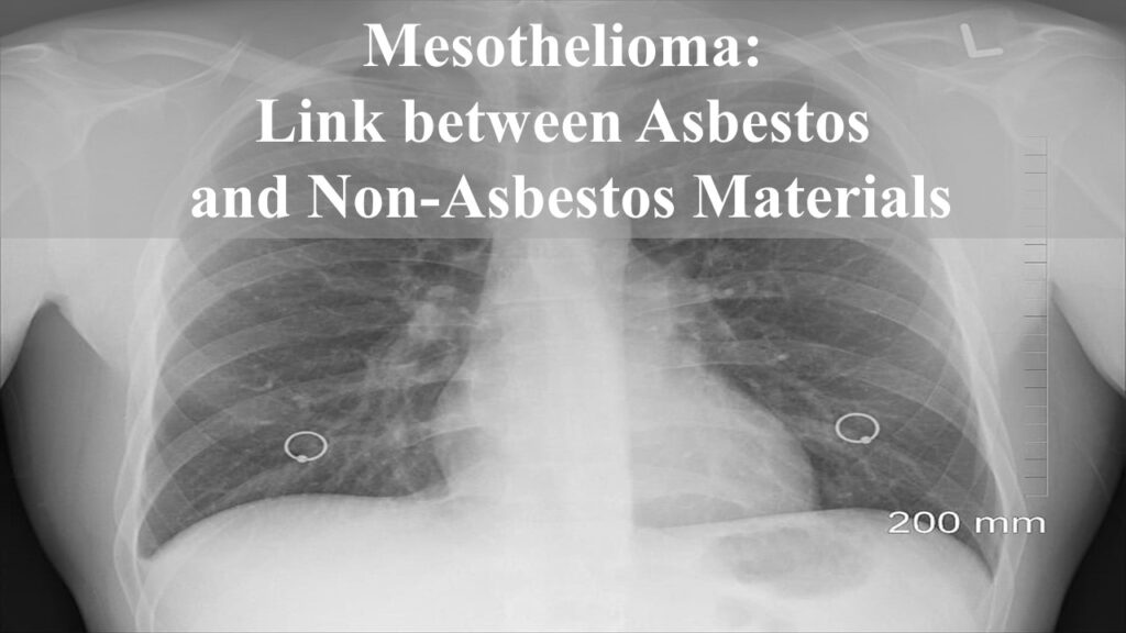 Chances Of Getting Mesothelioma From Asbestos Exposure Archives Yo Nature   Mesothelioma Links Asbestos Non Asbestos Yonature 1024x576 